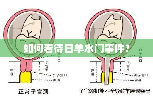 如何看待日羊水门事件？